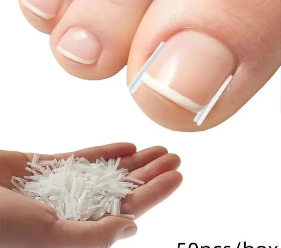 50Pcs Ingrown Toenail Correction Tool Ingrown Toe Nail Treatment Elastic Patch Sticker Straightening Clip Brace Pedicure Tool