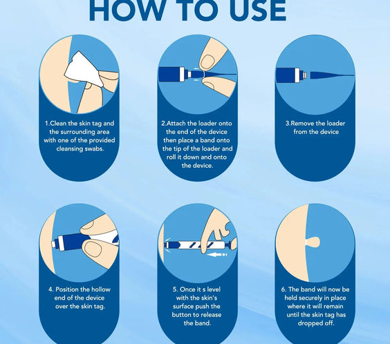 3 In1 Painless Auto Skin Tag Mole Wart Removal Kit Cleaning Tool Care Body Wart Dot Treatment for 1-4Mm Beauty Health Hot Sale