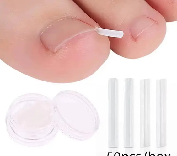 50Pcs Ingrown Toenail Correction Tool Ingrown Toe Nail Treatment Elastic Patch Sticker Straightening Clip Brace Pedicure Tool