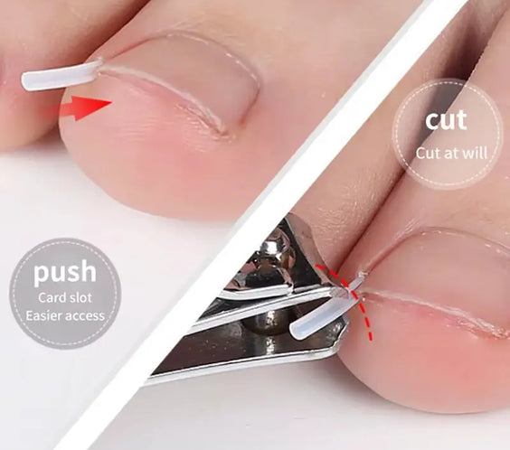 50Pcs Ingrown Toenail Correction Tool Ingrown Toe Nail Treatment Elastic Patch Sticker Straightening Clip Brace Pedicure Tool